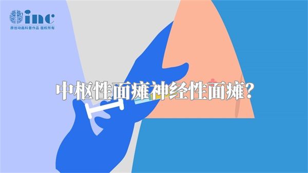 中枢性面瘫神经性面瘫？