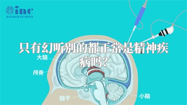 只有幻听别的都正常是精神疾病吗？