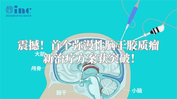 震撼！首个弥漫性脑干胶质瘤新治疗方案获突破！