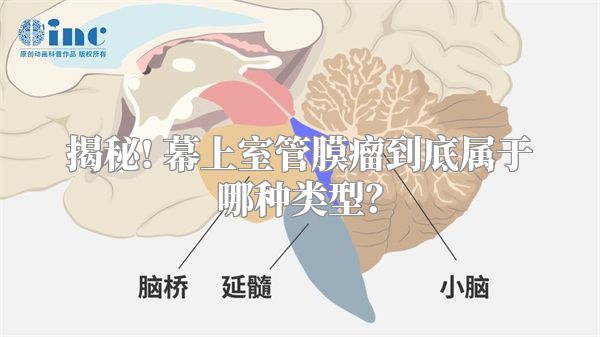 揭秘! 幕上室管膜瘤到底属于哪种类型？