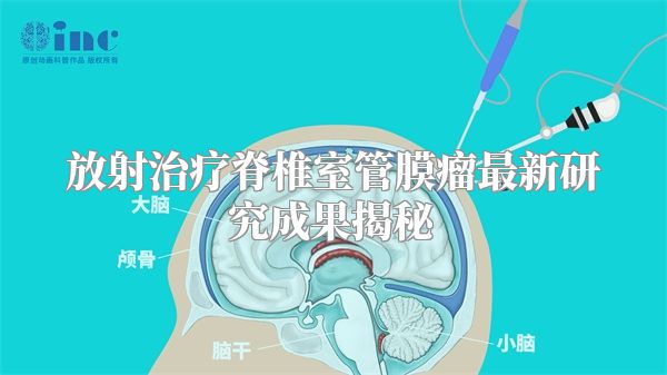 放射治疗脊椎室管膜瘤最新研究成果揭秘