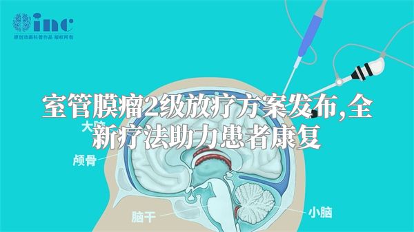 室管膜瘤2级放疗方案发布,全新疗法助力患者康复