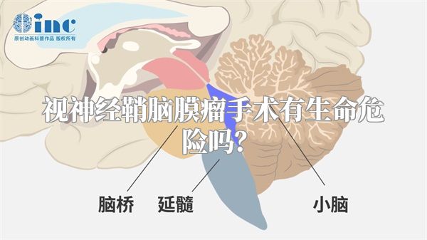 视神经鞘脑膜瘤手术有生命危险吗？