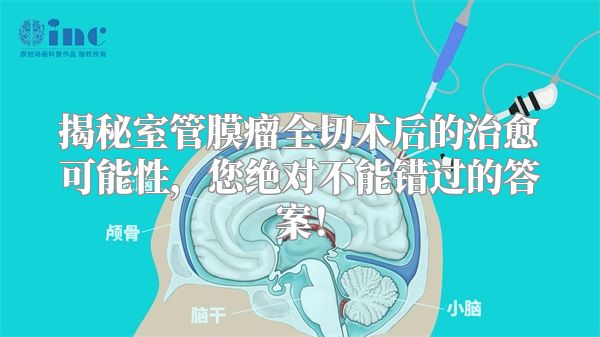 揭秘室管膜瘤全切术后的治愈可能性，您绝对不能错过的答案！