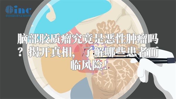 脑部胶质瘤究竟是恶性肿瘤吗？揭开真相，了解哪些患者面临风险！