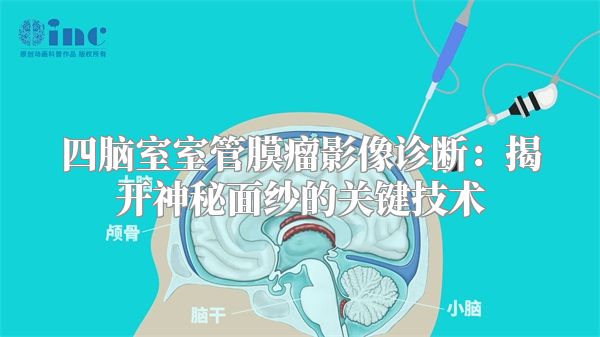 四脑室室管膜瘤影像诊断：揭开神秘面纱的关键技术