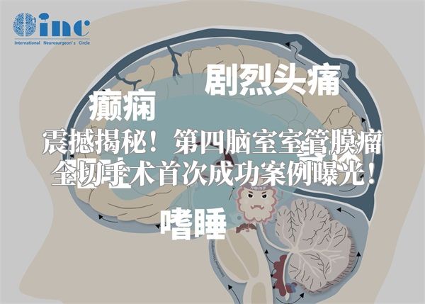 震撼揭秘！第四脑室室管膜瘤全切手术首次成功案例曝光！