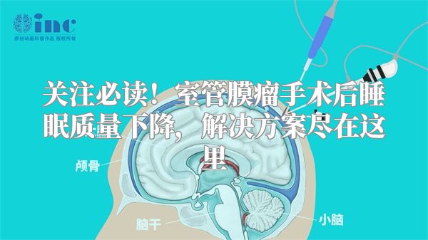 关注必读！室管膜瘤手术后睡眠质量下降，解决方案尽在这里