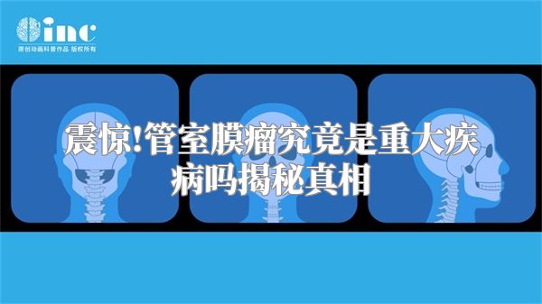 震惊!管室膜瘤究竟是重大疾病吗揭秘真相
