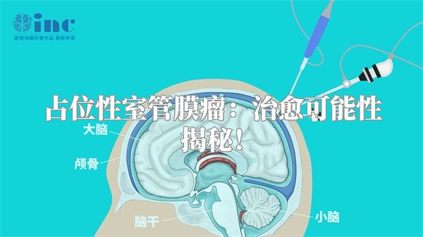 占位性室管膜瘤：治愈可能性揭秘！