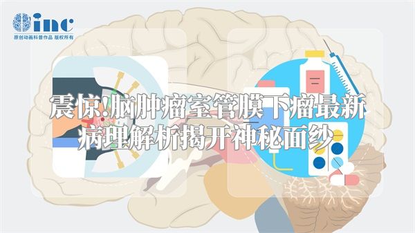 震惊!脑肿瘤室管膜下瘤最新病理解析揭开神秘面纱
