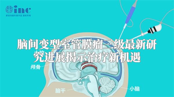 脑间变型室管膜瘤三级最新研究进展揭示治疗新机遇