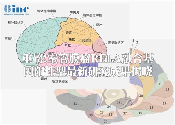 重磅!室管膜瘤RELA融合基因阳性型最新研究成果揭晓