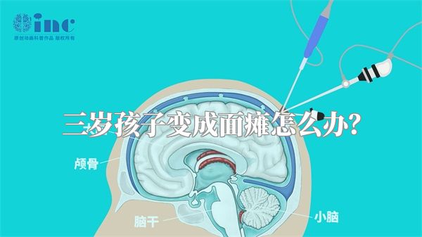 三岁孩子变成面瘫怎么办？