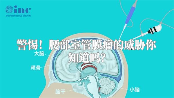 警惕！腰部室管膜瘤的威胁你知道吗？
