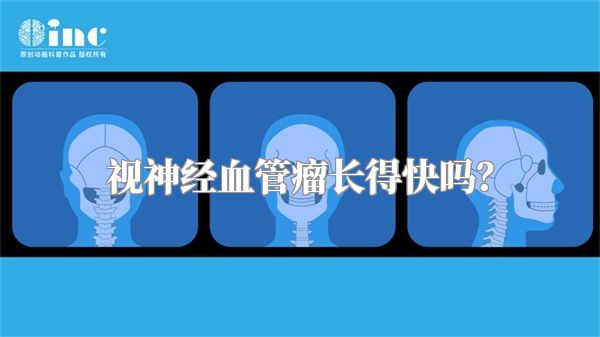 视神经血管瘤长得快吗?