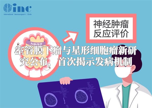 室管膜下瘤与星形细胞瘤新研究公布，首次揭示发病机制