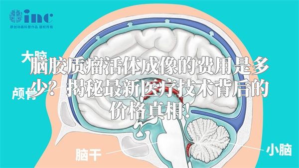脑胶质瘤活体成像的费用是多少？揭秘最新医疗技术背后的价格真相！