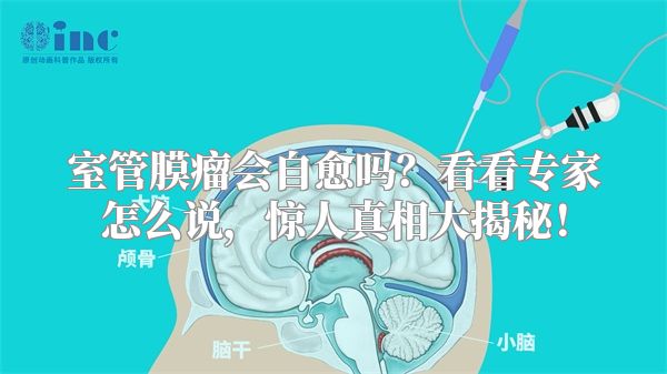 室管膜瘤会自愈吗？看看专家怎么说，惊人真相大揭秘！