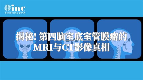 揭秘! 第四脑室底室管膜瘤的MRI与CT影像真相
