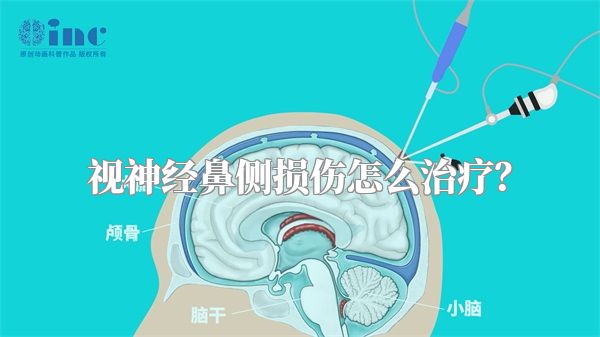 视神经鼻侧损伤怎么治疗？