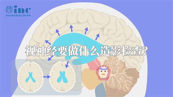 视神经要做什么造影检查？