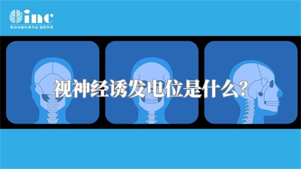 视神经诱发电位是什么?