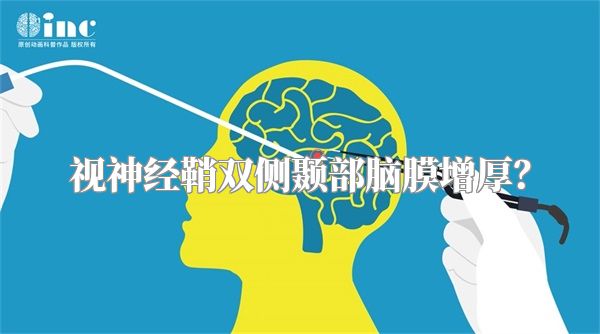 视神经鞘双侧颞部脑膜增厚?