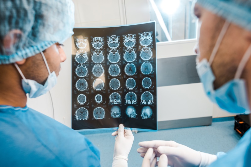 手机辐射可能会增加脑胶质瘤复发