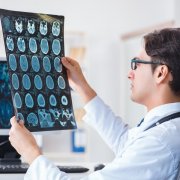 脑胶质瘤能治愈吗?